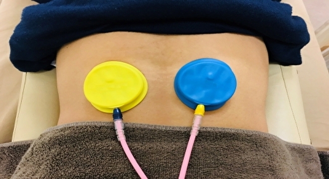 あさか訪問はりきゅう